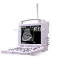 Portable Laptop Ultrasound Scanner Ultrasound Machine Price